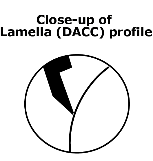 Lamella (DACC) Profile